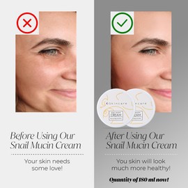 x2 Premium Snail Mucin Essence Cream with Hyaluronic Acid – Advanced Skin Repair, Deep Hydration, Blemish & Fine Line Reduction – Korean-Inspired Formula, 90ml