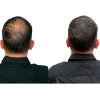 Fully Hair Hairline Powder Polvo Para Retocar Cuero