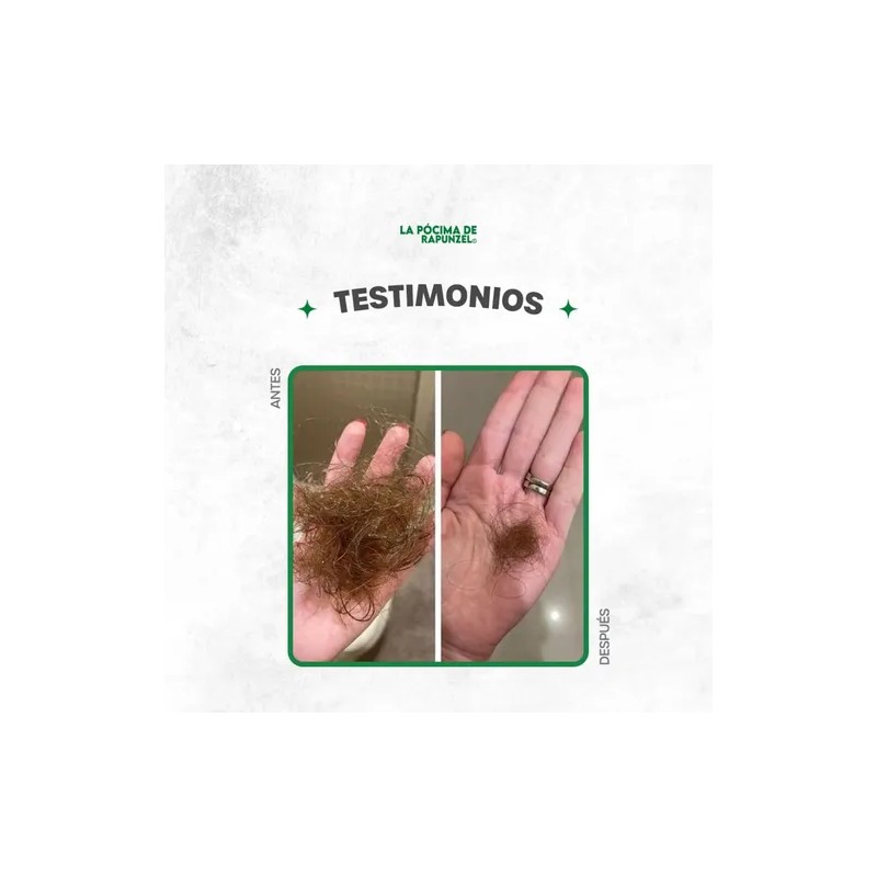 Kit Shampoo Fortificante Anticaída +acondicionador De Regalo