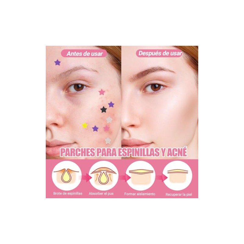 Parches para Acne, 600 PCS Parches para Granos de Estrella.