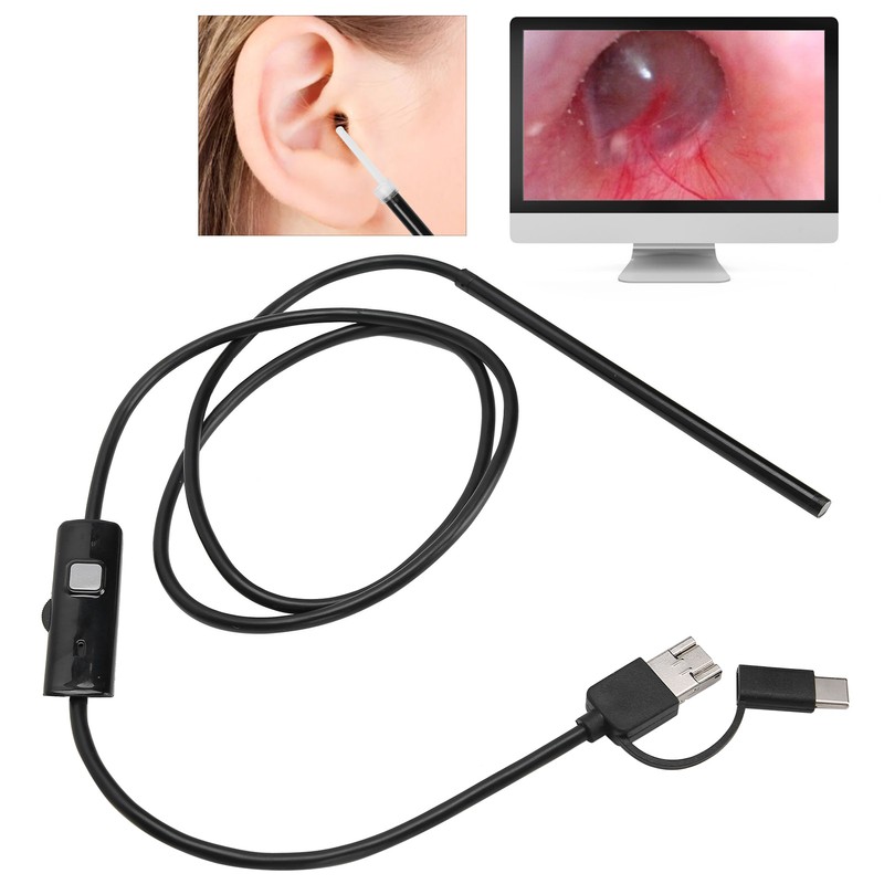 3‑in‑1 Visual Earwax Remover Luminous Ear Endoscope Earwax Cleaning Removal