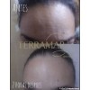 Fresh Terramar fresh Mango Facial Rellenador De Arrugas Wrinkle Filler