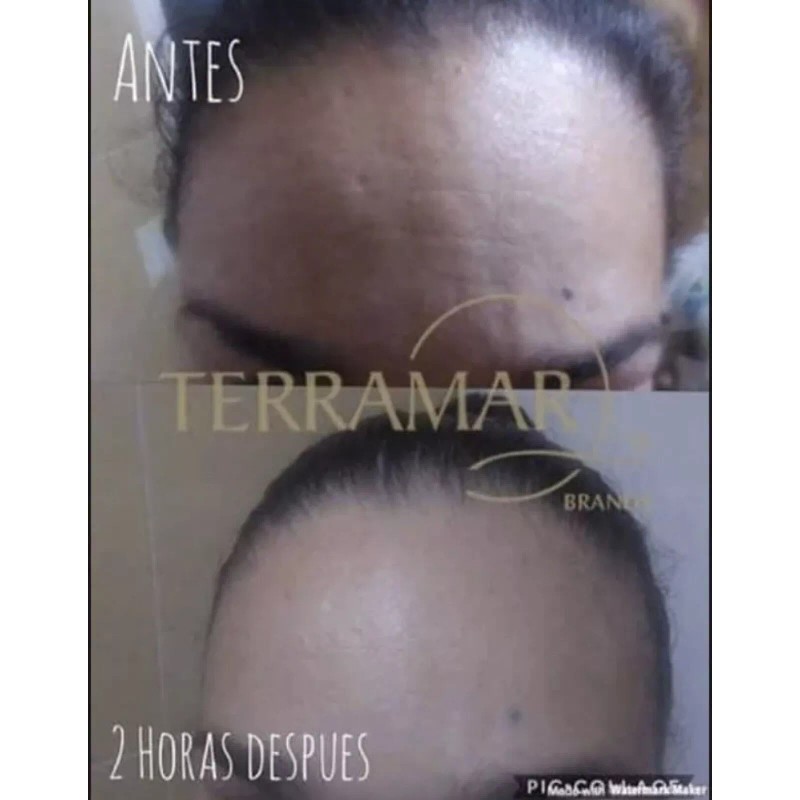 Fresh Terramar fresh Mango Facial Rellenador De Arrugas Wrinkle Filler