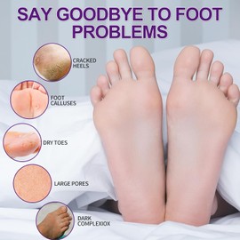 Kit de pedicura de spa, kit de remojo de pies de pedicura, tratamiento de spa en casa, kit de cuidado de pies 4 en 1 con remojo de pies, loción exfoliante de pies para pies secos agrietados