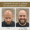 Zero Shine Spf Elimina El Brillo Y Protege Tu Cabeza