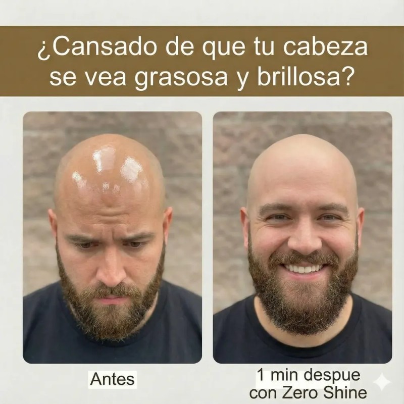 Zero Shine Spf Elimina El Brillo Y Protege Tu Cabeza