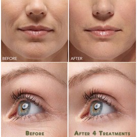 Hyaluronic Acid Gel Cream - Anti-Aging Wrinkle Face & Eye (HA) Serum Moisturizer