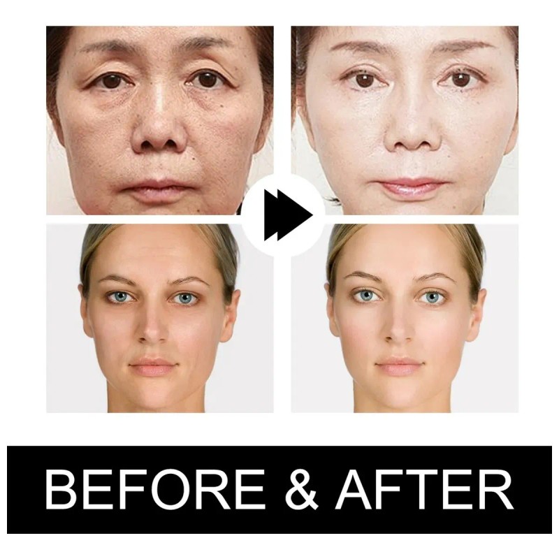 Mopoyat - Srum Facial Con Vitamina C, Hidrata Y Nutre