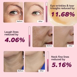 Calcium Multi Balm Stick for Face, Eyes, Lips & Neck – Korean Collagen Moisturizing Balm with Vitamin D & Shea Butter – Firming, Hydrating & Skin Barrier Care Stick for All Skin Types