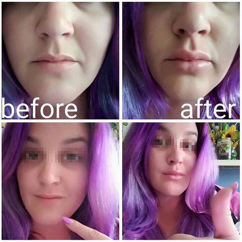 Lip Enhancement, Fish-Shaped Lip Pump, Sexy Lips Plumper Lip Enhancement