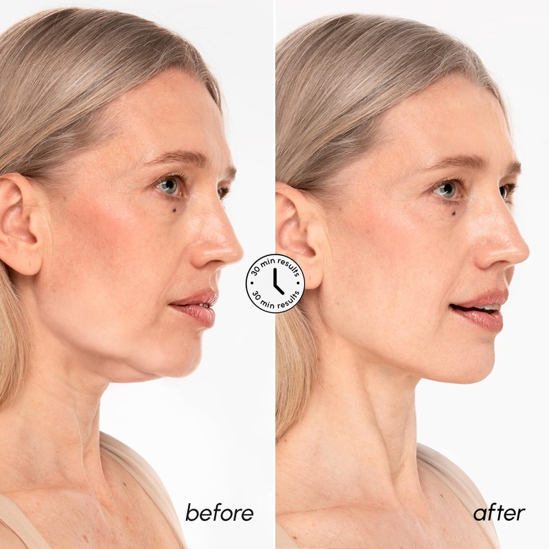 MAREE V Line Lifting Mask with 24K Gold – Deep