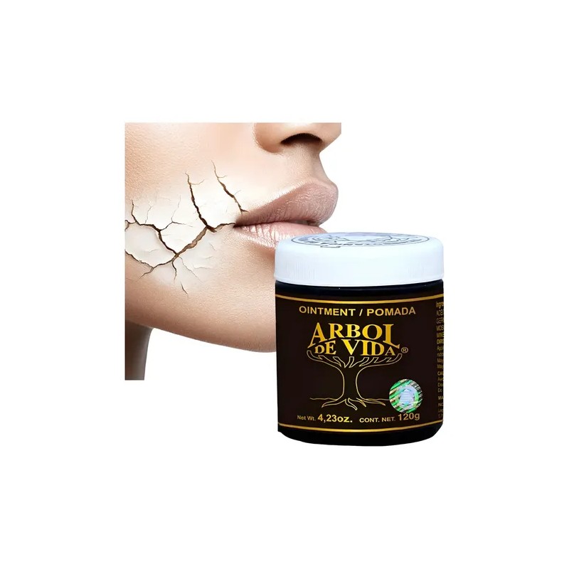 Pomada Tepezcohuite Árbol De Vida Natural Skin Cream, 120g