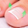 Universo en Linea Kit Corrección Uñas Enterradas Corrector Uñas Encarnadas