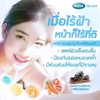 Nakarad Pynocare White Treatment of Melasma 20 Capsules