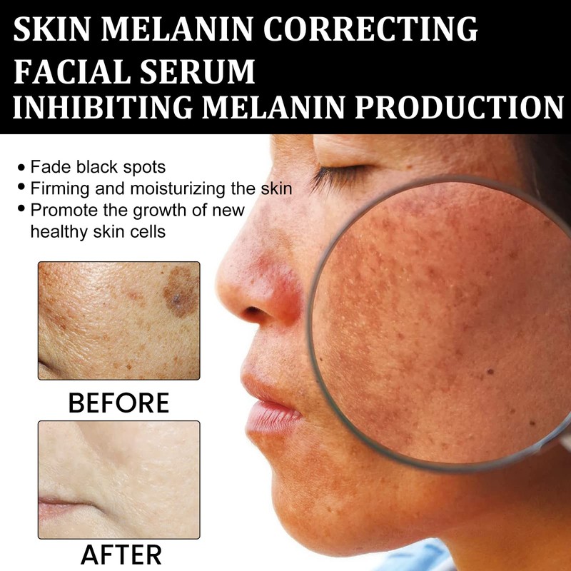Melanin Correcting Facial Serum, Dark Spot Corrector Daily Face Serum,