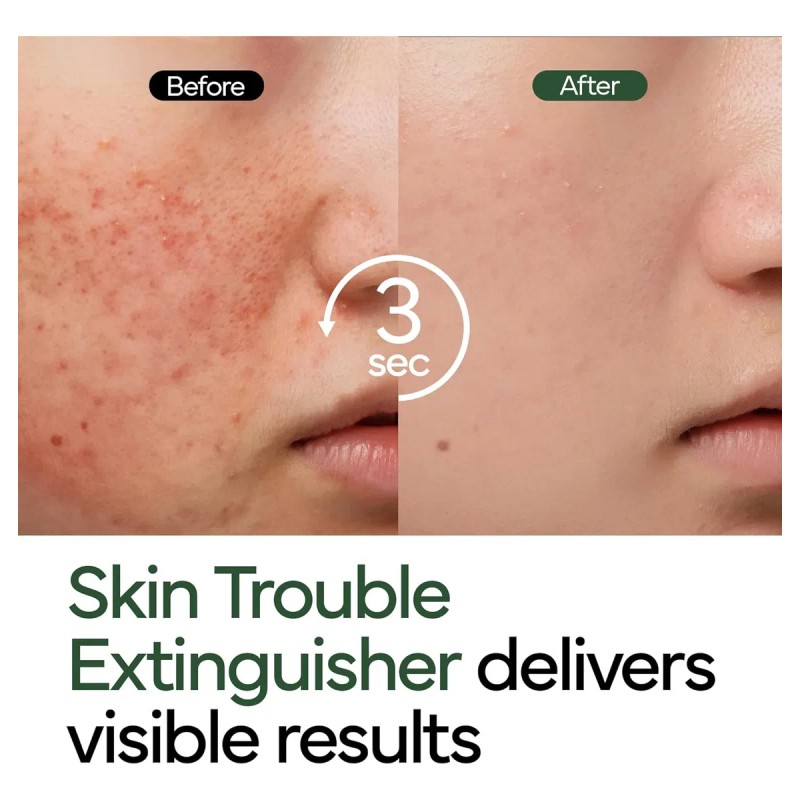 Intensive Cica Repair Cream (Korean, with Dexpanthenol) ✨🌿 skin care