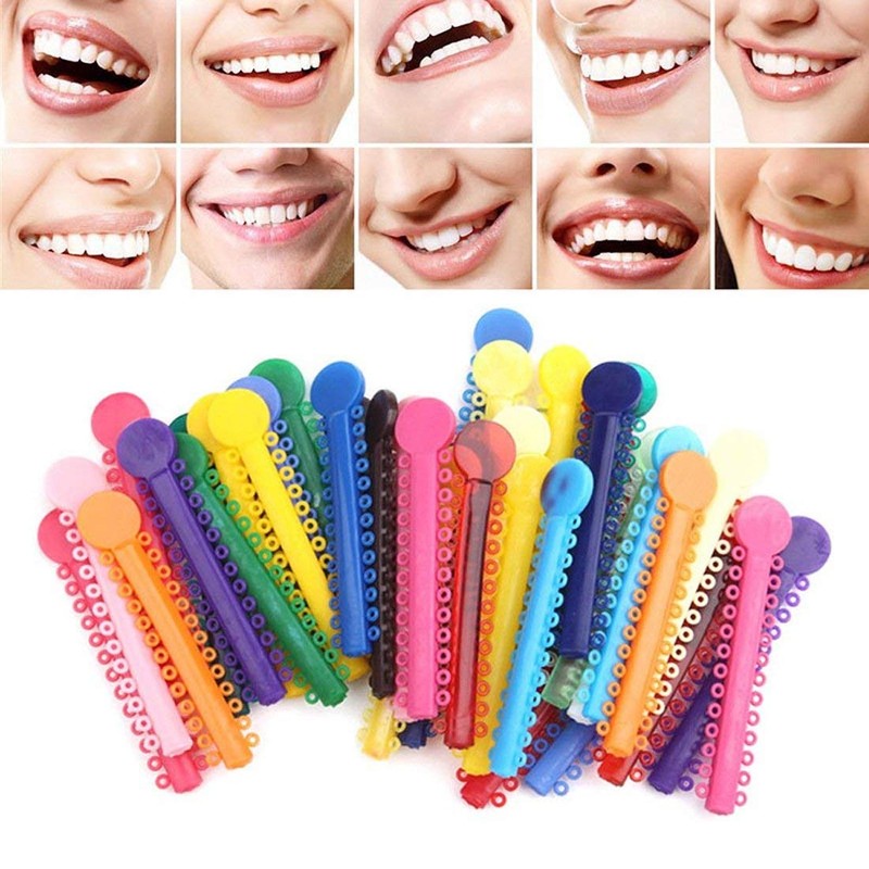 Chargenyang 1040pcs Orthodontic Ligature Ties Multi-Color Orthodontic Elastomeric O-Rings Braces