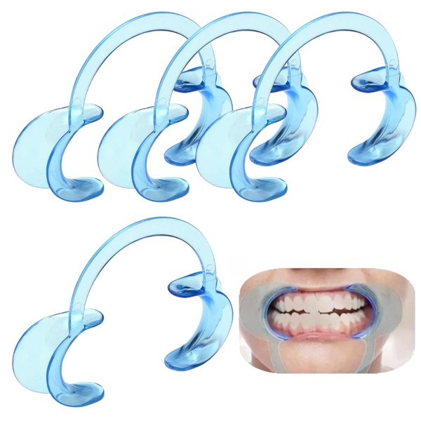 C-Shape Mouth Opener, Dental C-Shape Mouth Opener, Mouth Opener Challenge,