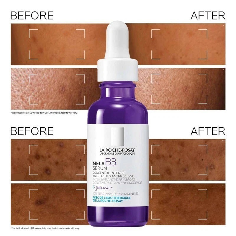 La Roche-Posay NEW 'La Roche-Posay' Mela B3 Intensive Anti -