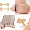 Toenail protection tape Toenail tape Fixing toenails when toenails are digging Into toenails Claw protection 7ea