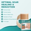 Silicone Scar Sheets, Silicone Scar Tape(1.6"x 158"), Scar Tape for