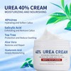 Urea Cream 40% for Feet, Hands, Heels & Elbows -