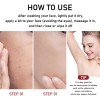 Phofay Sérum Exfoliación Niacinamida Ácido Tendencia Acnéica