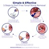 Oravix Tonsil Stone Vacuum, Tonsil Stone Remover Vacuum Suction, Tonsil