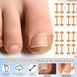 20 Piezas Kit Para Uas Enterradas, Professional Ingrown Toenail Set, Uas Enterradas, Incluye Almohadillas, Herramientas y Cortaas, Kit de Correccin...