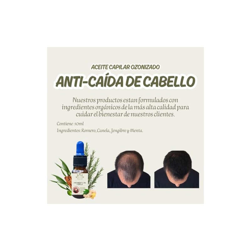 Aceite Capilar Ozonizado Romero Anti-caida De Cabello (10 ML)