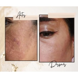 Crema Despigmentante Artesanal Orgánica