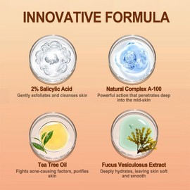 Butt Acne Clearing Treatment, Body Cream for Back, Buttocks, Thigh & Chest Acne, Skin Clearing Lotion for Men & Women 5.46 oz