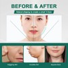 ZKGYUS Reusable chin strap, V-shaped chin face tightening band, face