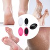 3-Piece Egg-Shaped Foot Files, Exfoliating Foot Rub, Manual Foot Scrub,