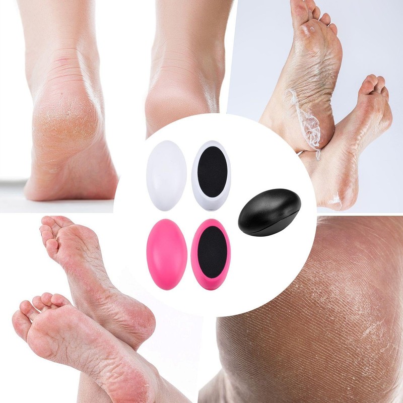 3-Piece Egg-Shaped Foot Files, Exfoliating Foot Rub, Manual Foot Scrub,