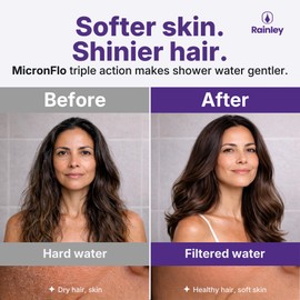 Rainley Bossa Showerhead Filter for Municipal & Well Hard Water – Relieves Dry Skin, Eczema & Frizzy Hair for Sensitive Skin & Hair | Micron Filtration Removes Chlorine, Heavy Metals & Microplastics