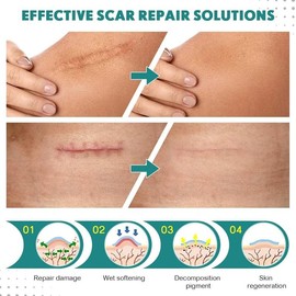 PUMKOT Professional Silicone Scar Sheets & Scar Cream – Reusable Anti-Aging, Dark Spot & Keloid Treatment