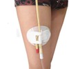 Lifevv 5 PCS Catheter Legband Holder,Surface Tube fix Device with
