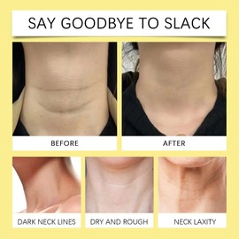 Neck Firming Cream,Neck Firming Tightening Cream,Anti-Aging Neck Cream,Tighten & Lift Firming Neck Cream,Firming Cream for Loose Skin,Day Cream for Women Anti Aging,Wrinkle Cre-am for Women,Ne-ck Lift