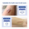 MURASAKI BEAUTY Silicone Scar Tape & Sheets – Removal on