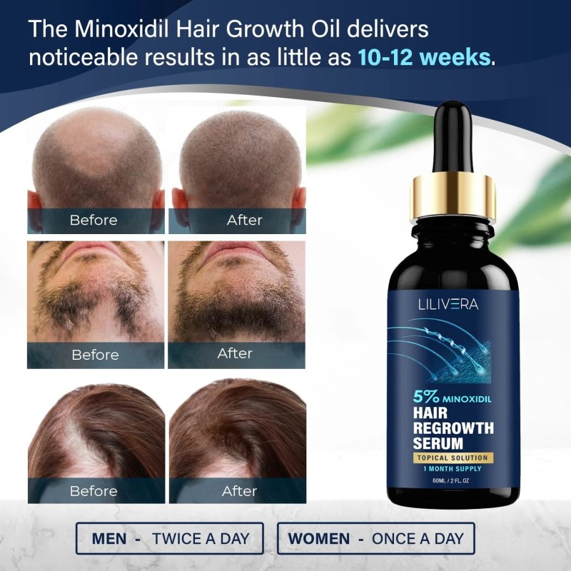 LILIVERA Hair Growth Serum for Men and Women Kit