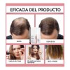 🌿💧 Rosemary Hair Oil 120ml – Intensive Repair & Growth