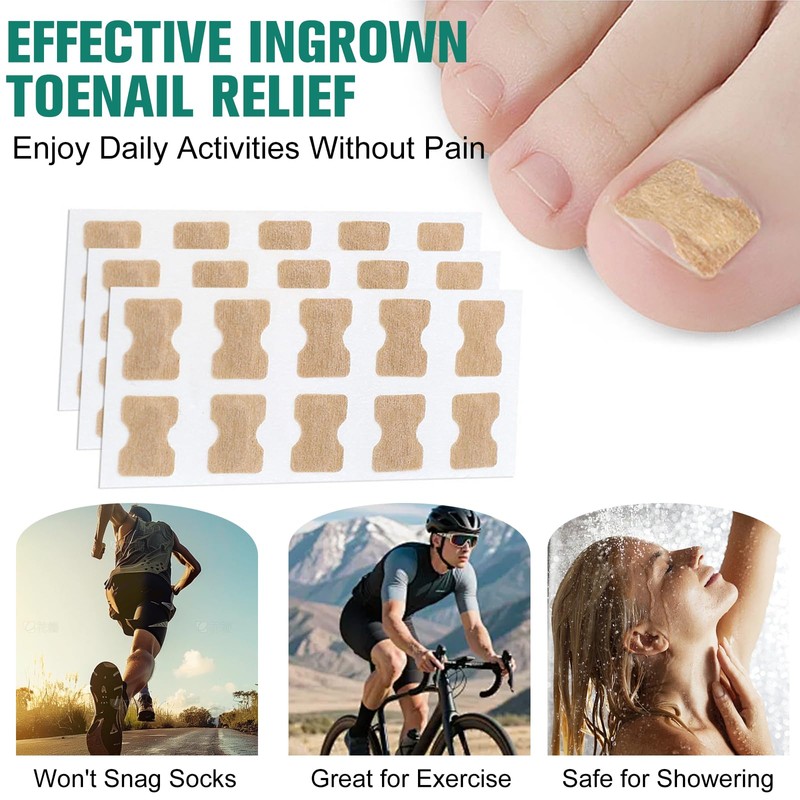 Pack of 50 Toenail Correction Patches for Ingrown Toenails -
