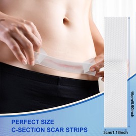 C Section Scar Silicone Strips Reusable Medical Grade Silicone Scar Sheets for Tummy Tuck, Keloid, and Surgical Scars Treatment (4 Pack)