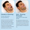 Anti Snoring Device Mouth Guard - Snoring Solution Tongue Mouthpiece