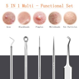LOPHE Blackhead Remover Tool Kit, 5PCS Pimple Popper Tool Kit Stainless Steel Comedone Extractor Tweezers Acne Needle Pimple Popping Kit for Removing Pimple Blackheads Zit on Forehead Facial Nose