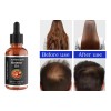 . 2 × Esencia For El Crecimiento Del Cabello, Aceite