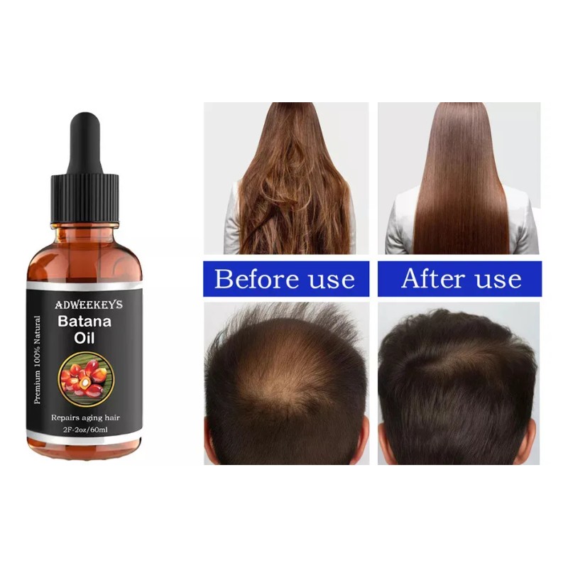 . 2 × Esencia For El Crecimiento Del Cabello, Aceite