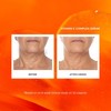 Naturium Vitamin C Complex Face Serum with Hyaluronic Acid &