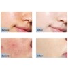 Wonsters 3er Set Facial Konzentrat, Peeling Solution Hydra Facial Serum,